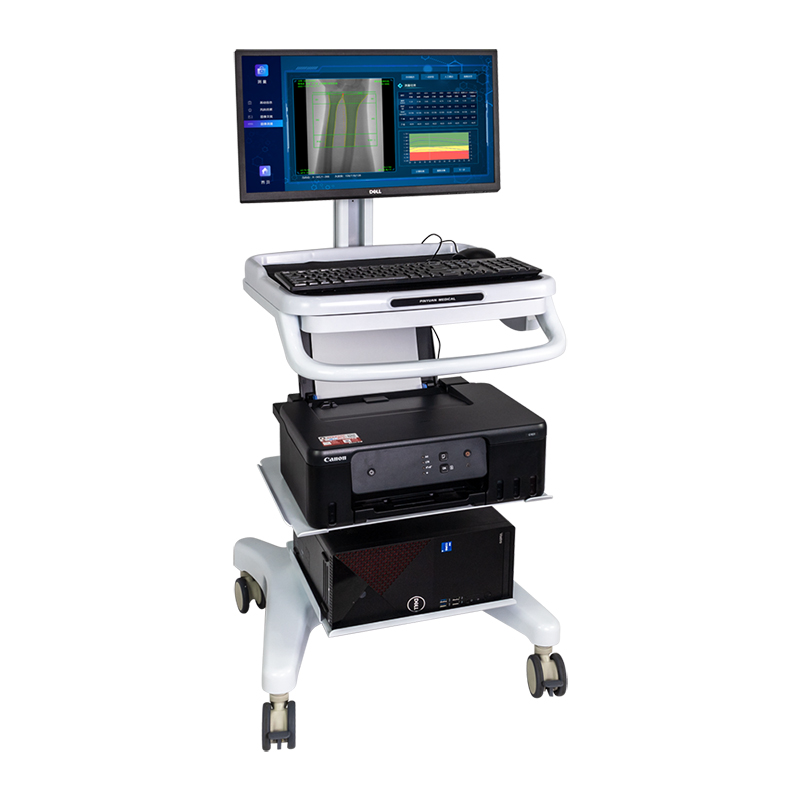 雙能X射線骨密度儀